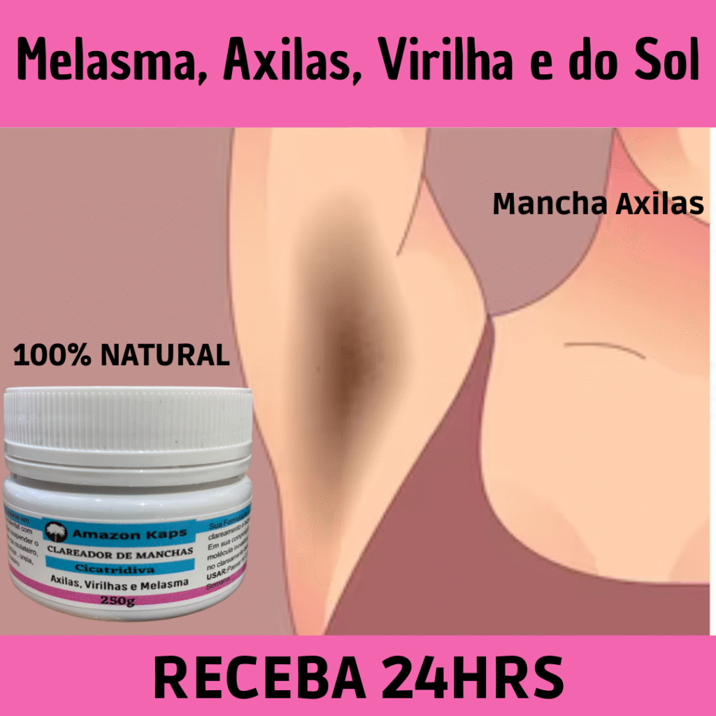 Resultado antes e depois - melasma